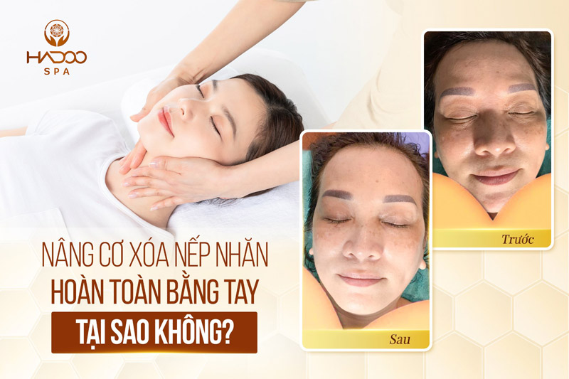 Nâng cơ xóa nếp nhăn hoàn toàn bằng tay - tại sao không?